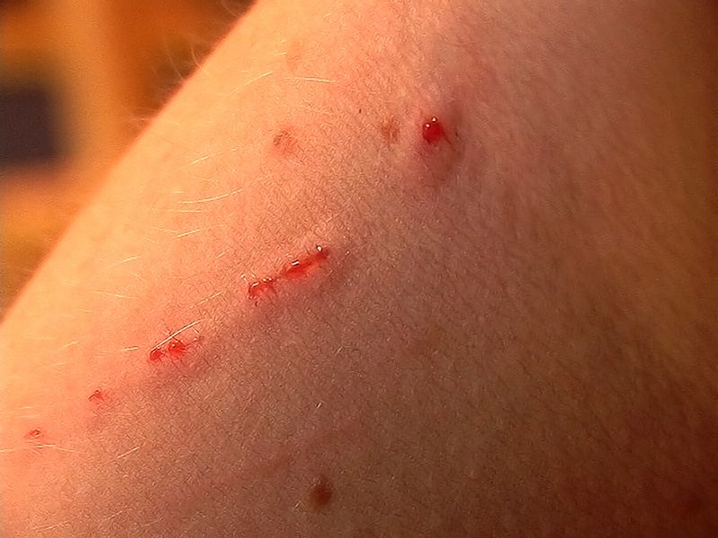 3. Common Symptoms