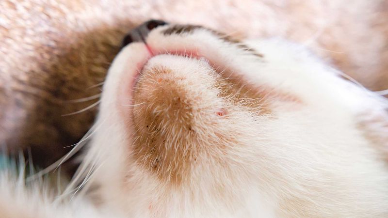 Overactive Sebaceous Glands