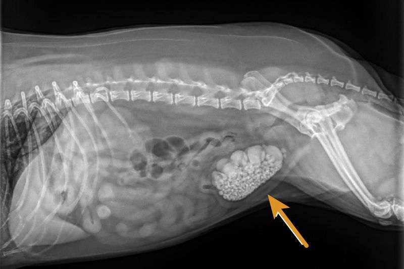 Bladder Stones (Urolithiasis)