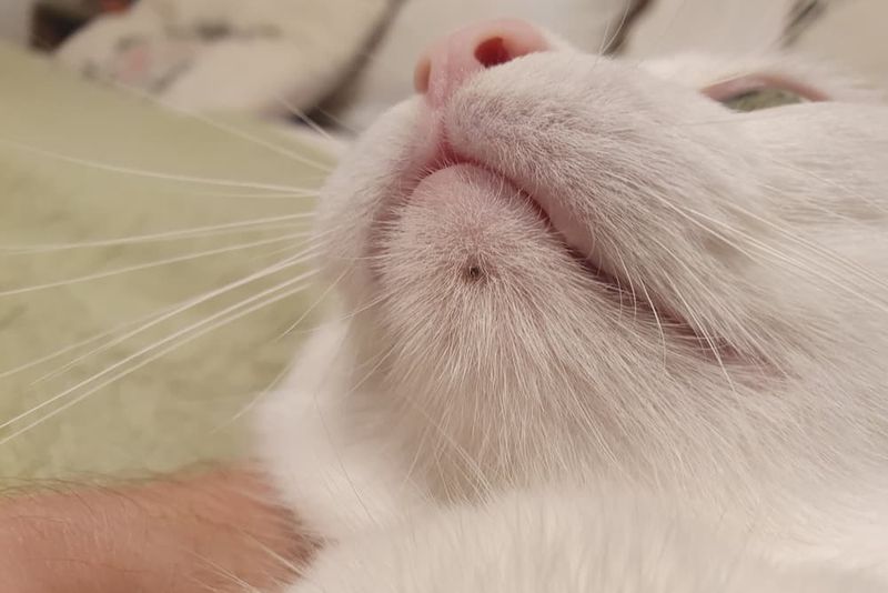 Poor Grooming Habits