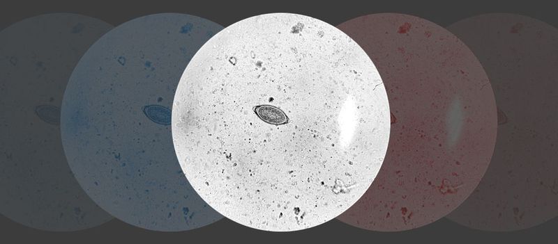 What parasites can be detected?