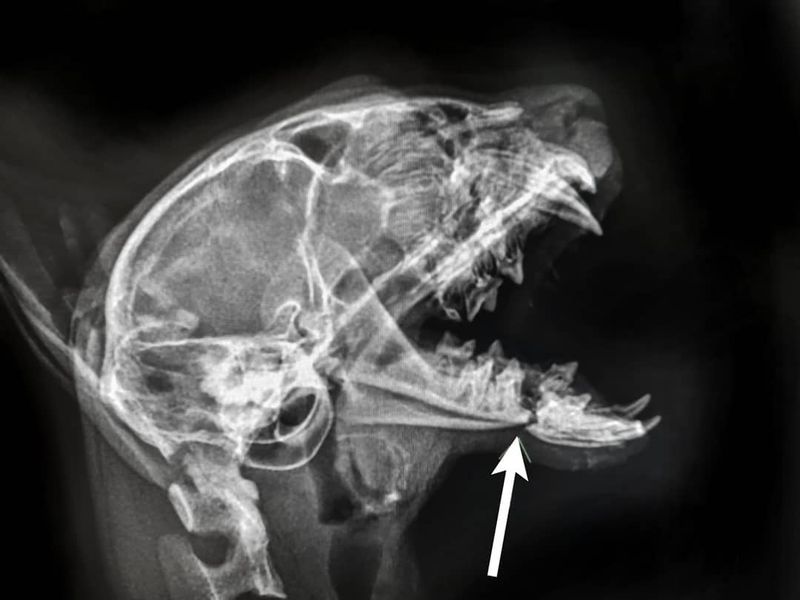Jaw or Bone Abnormalities