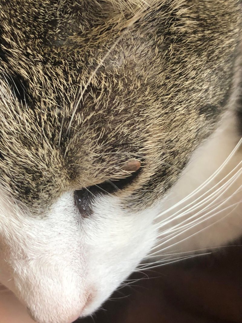 Around the Eyes and Eyelids