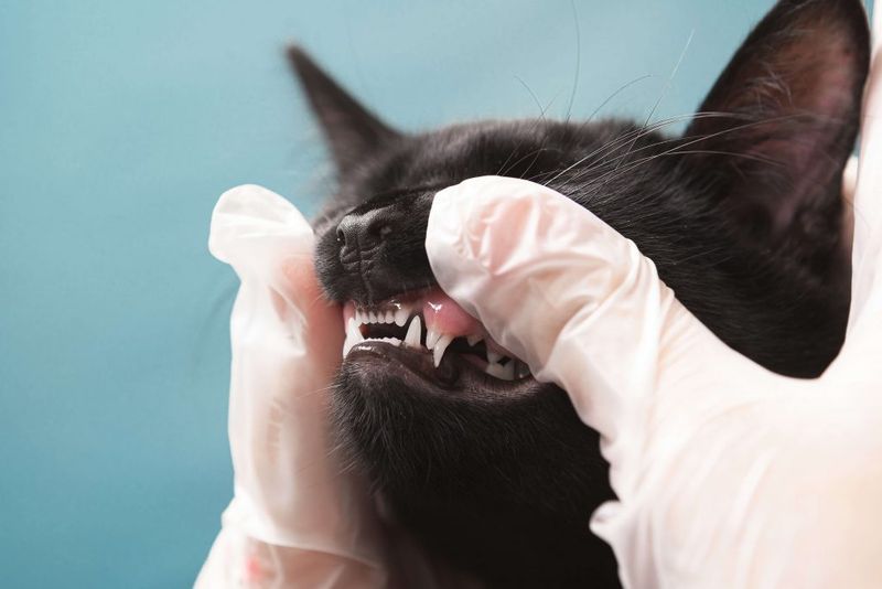 Teeth