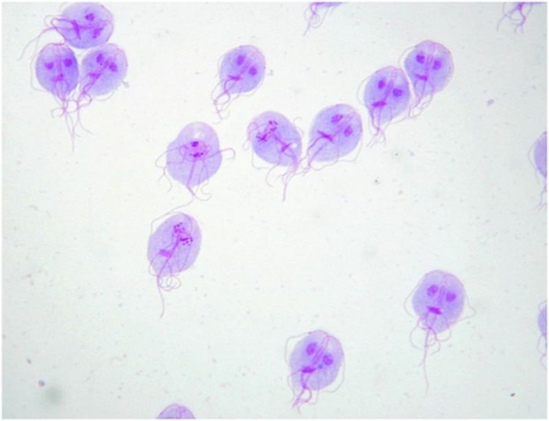 Giardia