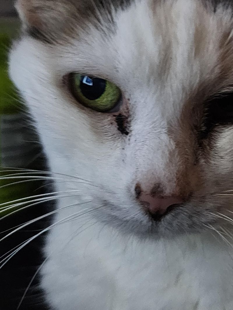 Sunken Eyes
